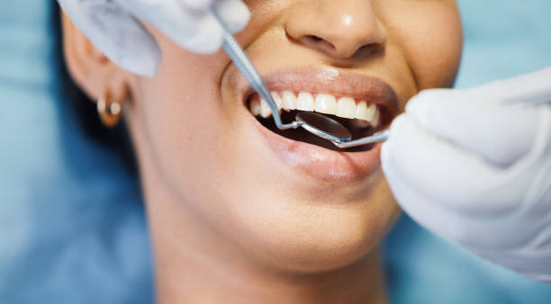 Best Emergency Gum Treatment in Oakville, CT